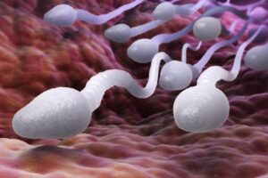 Solusi Ampuh Mengatasi Masalah Sperma Encer
