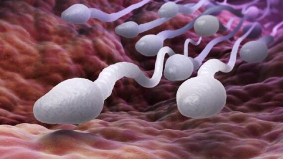 Solusi Ampuh Mengatasi Masalah Sperma Encer